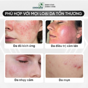 BIO SUNSCREEN – Kem chống nắng vật lý, dịu nhẹ cho da nhạy cảm