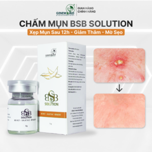 BSB SOLUTION – Dung dịch kháng khuẩn phục hồi da mụn