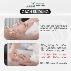 BSB SOLUTION – Dung dịch kháng khuẩn phục hồi da mụn