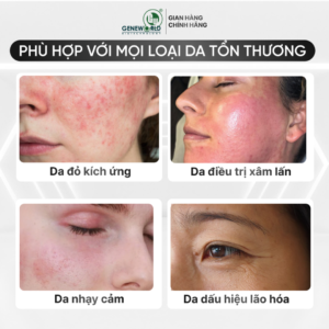G FACTOR – Serum tăng trưởng tế bào gốc