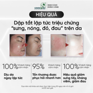 G-REDNESS – Serum giảm đỏ, chống kích ứng