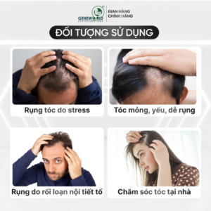 1FOTI HAIR – Tinh chất mọc tóc từ hà thủ ô & các hoạt chất thiên nhiên