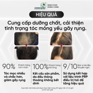 1FOTI HAIR – Tinh chất mọc tóc từ hà thủ ô & các hoạt chất thiên nhiên