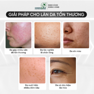 MICRO MASK PEEL – Mặt nạ vi tảo tẩy da chết sinh học