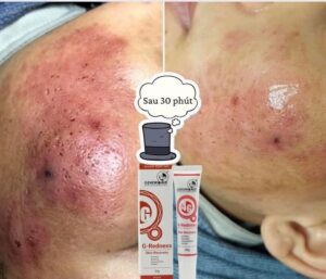 GENE CARE – GIẢI PHÁP CHĂM SÓC CHUYÊN SÂU CHO SPA HIỆN ĐẠI 2 1
