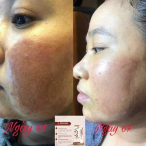 GENE CARE – GIẢI PHÁP CHĂM SÓC CHUYÊN SÂU CHO SPA HIỆN ĐẠI 3 2